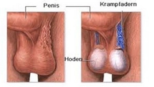 Erkek Yumurtalık Kisti Belirtileri ve Tedavisi