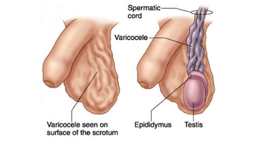 Erkek Yumurtalk Hastalklar
